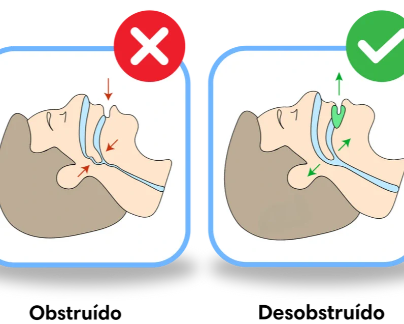 SILENT PRO ANTIRONQUIDO® #1 MÁS VENDIDO + EBOOK GRATUITO 🇨🇴